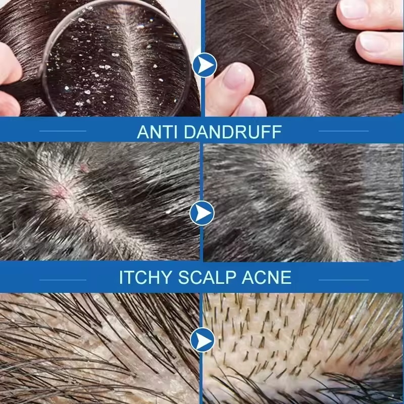 Fast Anti Dandruff Hair Treatm - Castor Oil Soap บทวิจารณ์และราคา