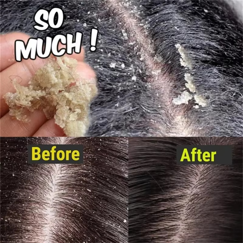 Fast Anti Dandruff Hair Treatm - Castor Oil Soap บทวิจารณ์และราคา